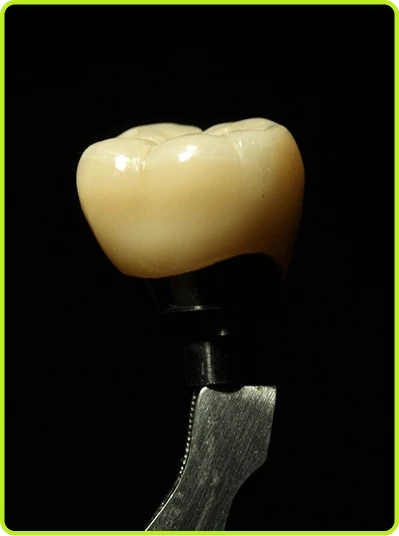 Dental Materials