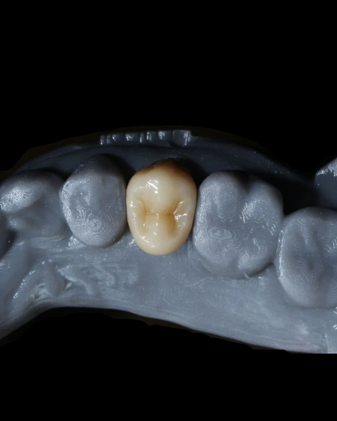 Zirconia